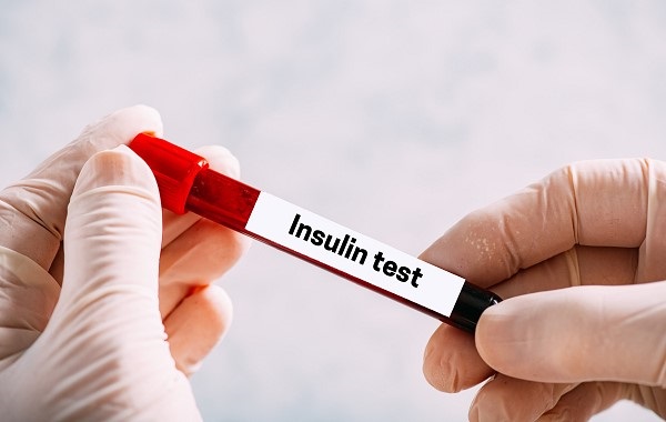 Xét nghiệm Insulin để phát hiện bệnh tiểu đường