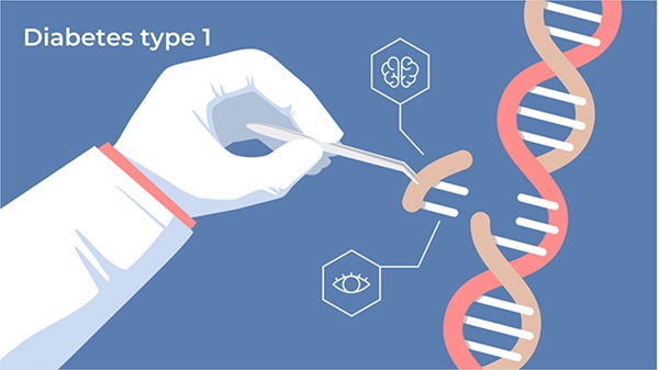 Tiểu đường di truyền type 1