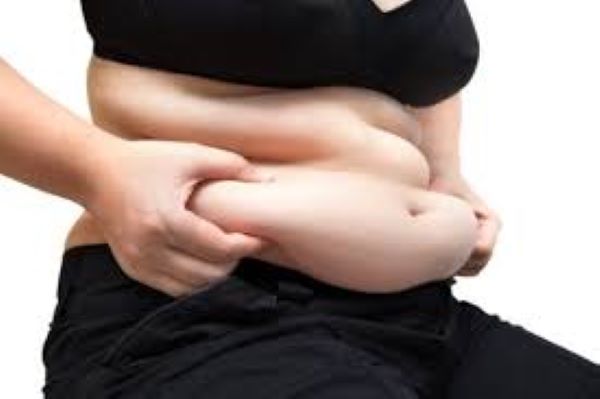 Triệu chứng thường gặp của béo phì độ 2 là tích tụ mỡ đặc biệt là quanh vùng eo.