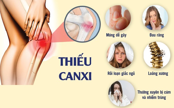Những triệu chứng thiếu canxi mà có thể bạn chưa biết - nanogroup